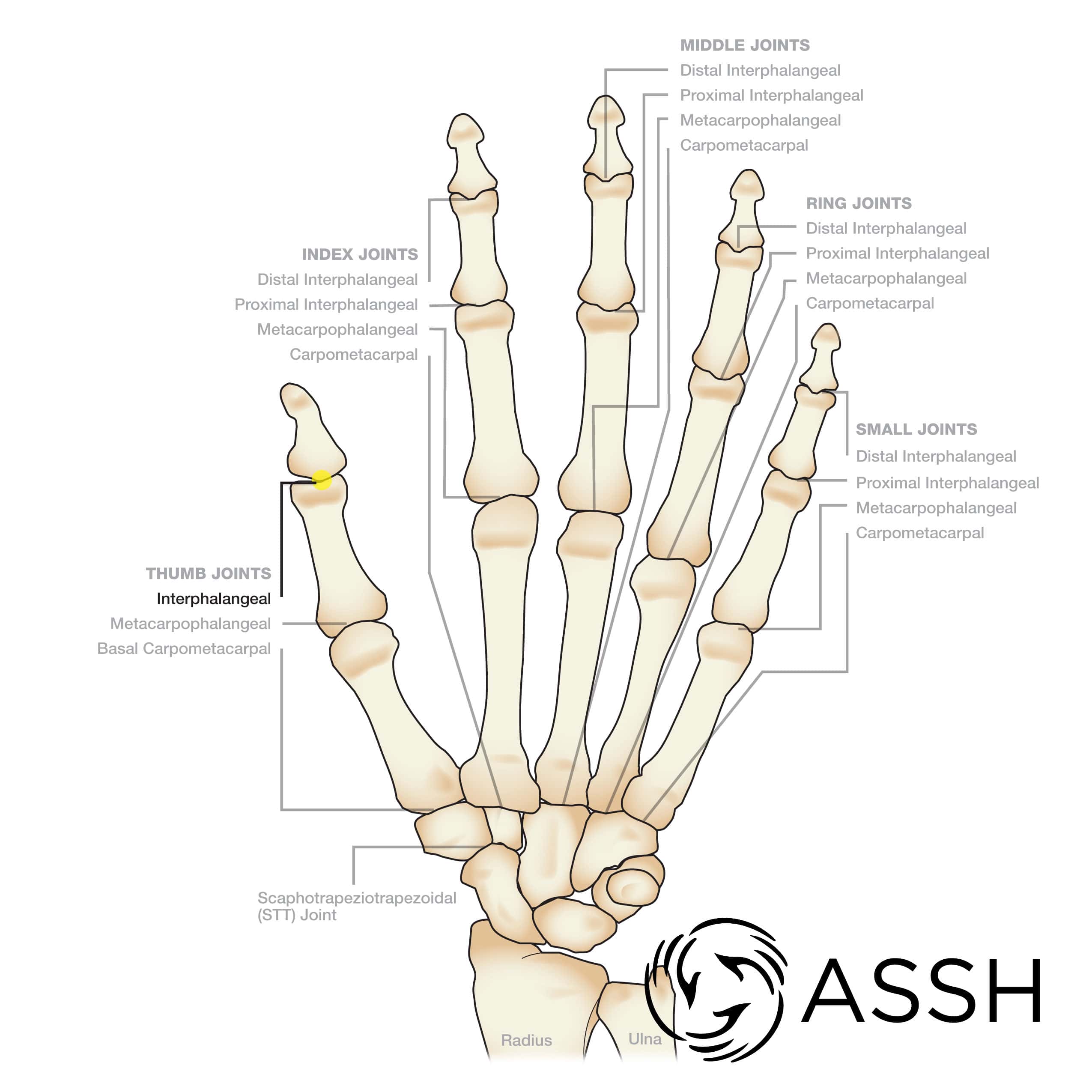 RussellWilsonfinger.jpg